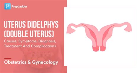 2 vaginas|Uterus didelphys